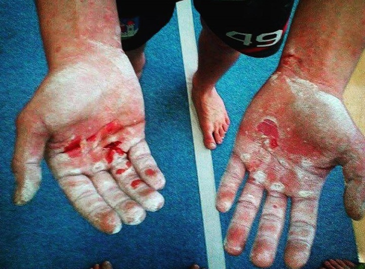 Mozoly na rukou street workout