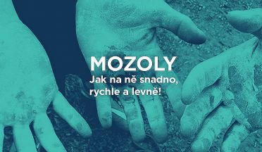 Jak na utržené mozoly na rukou z tréninku na hrazdě? Zaručené rady a triky jak skoncovat s mozoly!